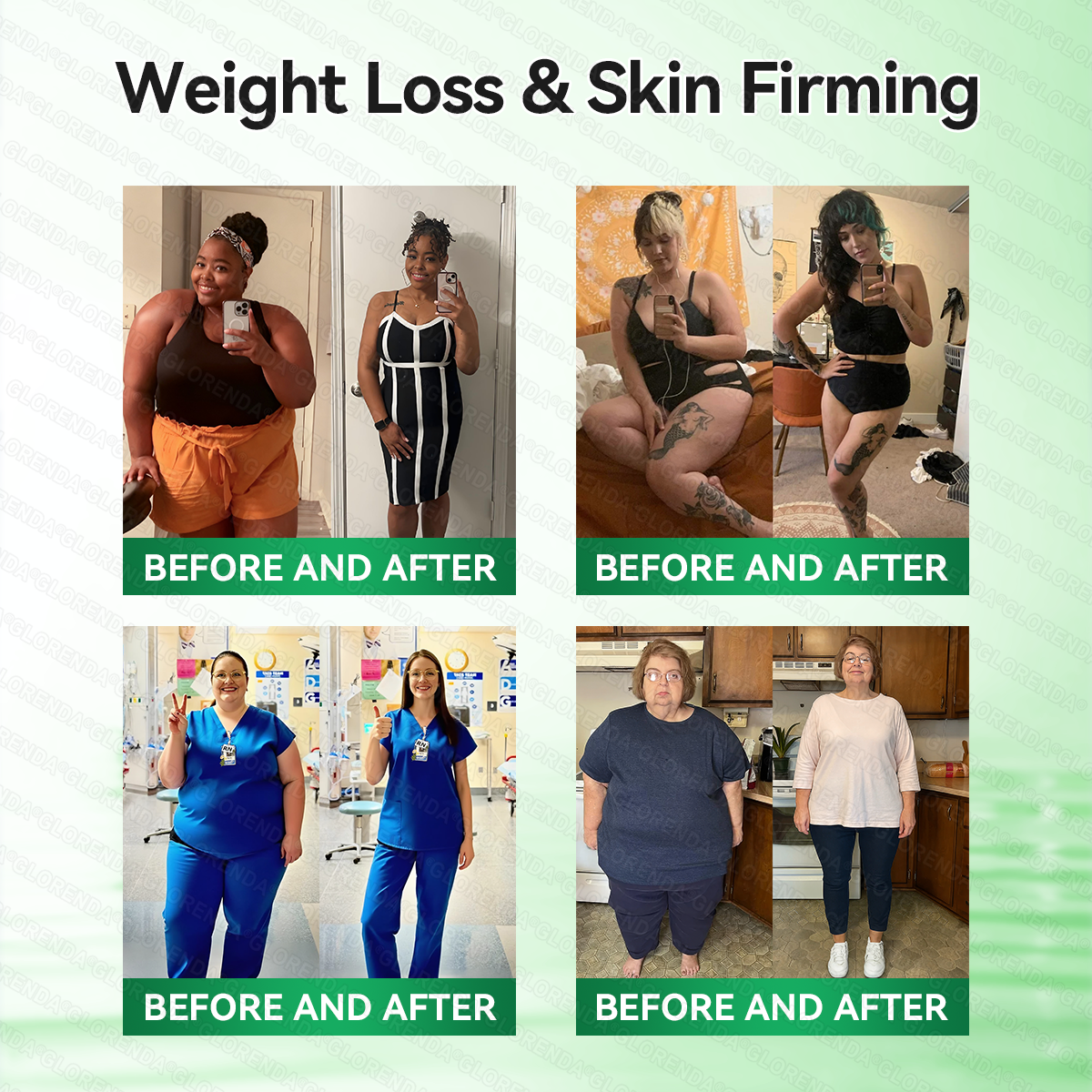 𝑶𝒇𝒇𝒊𝒄𝒊𝒂𝒍 𝑺𝒕𝒐𝒓𝒆  | 👩‍⚕️𝐆𝐋𝐎𝑹𝑬𝑵𝑫𝗔®𝑴𝒐𝒓𝒊𝒏𝒈𝗮 · 𝗕𝗲𝗿𝗯𝗲𝗿𝙞𝙣𝙚 × 𝙉𝘼𝐃+ 𝟏𝟎-𝐢𝐧-𝟏 𝗔𝗱𝘃𝗮𝗻𝗰𝙚𝙙 𝙉𝙖𝙣𝙤 𝙈𝙞𝙘𝙧𝙤𝙣𝙚𝙚𝐝𝐥𝐞 𝐏𝐚𝐭𝙘𝙝🇺🇸(𝐉𝐮𝐬𝐭 𝐨𝐧𝐜𝐞 𝐚 𝐝𝐚𝐲, 𝐯𝐢𝐬𝐢𝐛𝐥𝐞 𝐜𝐡𝐚𝐧𝐠𝐞𝐬 𝐢𝐧 𝟕 𝐝𝐚𝐲𝐬） ✅ 𝐅𝐨𝐫 𝐨𝐛𝐞𝐬𝐢𝐭𝐲, 🅛🅞🅞🅢🅔 🅢🅚🅘🅝,𝐝𝐢𝐚𝐛𝐞𝐭𝐞𝐬, 𝐬𝐥𝐞𝐞𝐩 𝐚𝐩𝐧𝐞𝐚, 𝐣𝐨𝐢𝐧𝐭 𝐢𝐬𝐬𝐮𝐞𝐬, 𝐚𝐧𝐝 𝐦𝐨𝐫𝐞